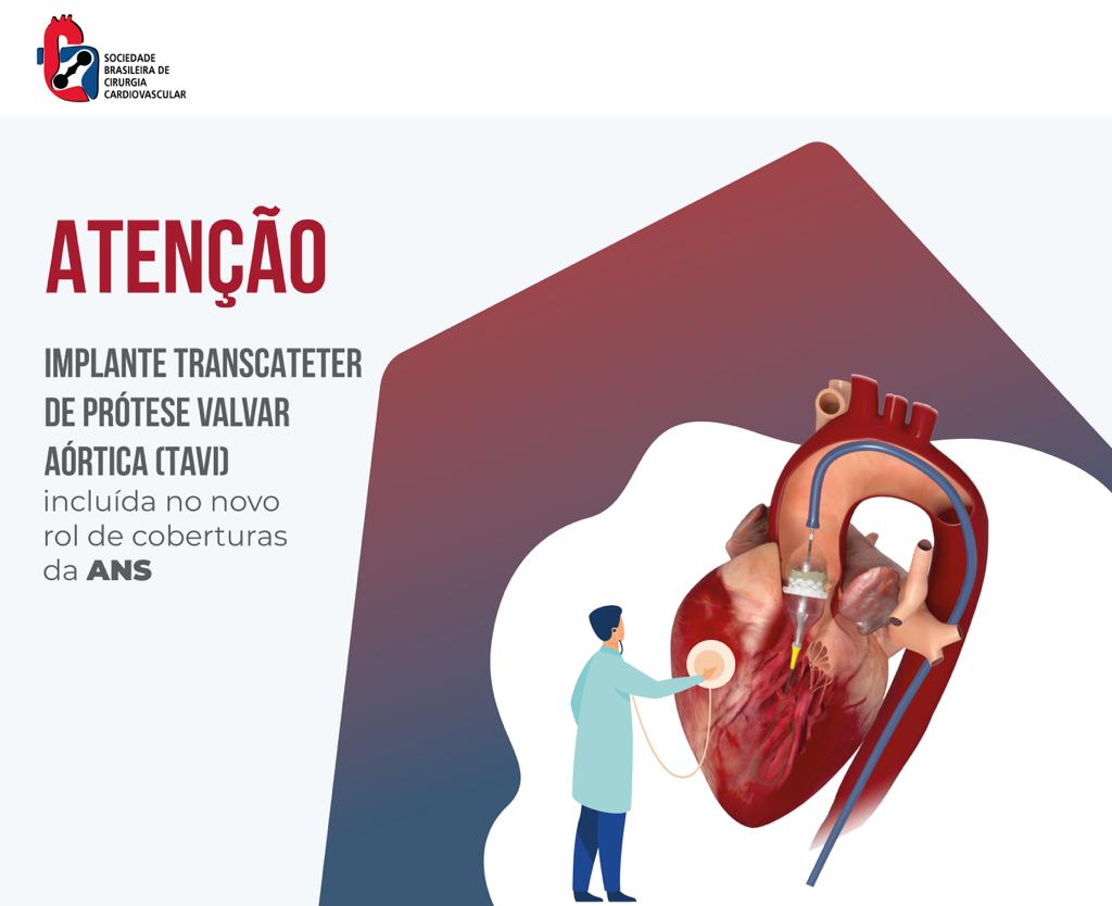 SBCCV - Sociedade Brasileira de Cirurgia Cardiovascular